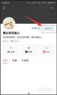头条如何设置收藏名字,打造个性化收藏夹标签