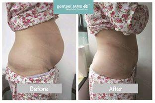 网红腹直肌修复视频,腹直肌修复全攻略，告别产后松弛，重塑完美身材